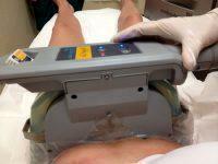 CoolSculpting Utilizes Cold Therapy