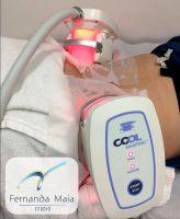 Coolshaping Offers Non-invasive Cryo Cooling To Reduce Fat Cells And Breaking Down The Fat