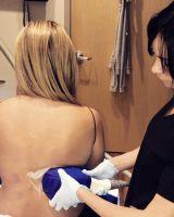 Does Coolsculpting Work On Back Fat