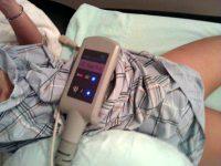 The CoolSculpting Procedure Is Right For You