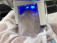 CoolSculpting Freezes Fat Cells