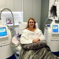 CoolSculpting - Removal Of Fat For The Arms