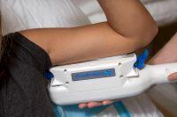 CoolSculpting To Treat Flabby Arms
