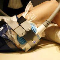 Coolsculpting Saddlebags Fat