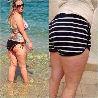 Fat & Cellulite Reduction