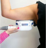 For The Right Patient CoolSculpting Works