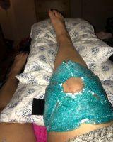 Ice Packs For Coolsculpting