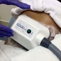 Liposuction And CoolSculpting Are Effective Methods For Removing Stubborn Fat Deposits