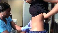 What Exactly Is CoolSculpting