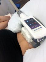 CoolSculpting, An Innovative Technology That Freezes Away Unwanted Fat