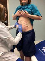 CoolSculpting Utilizes The Cryolipolysis Method To Effectively Freeze Fat Cells