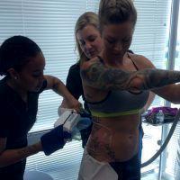 CoolSculpting's Non-surgical Cryolipolysis Technology