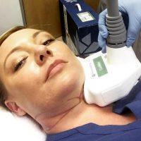 Coolsculpting For Double Chin
