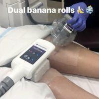 Coolsculpting For Dual Banana Rolls