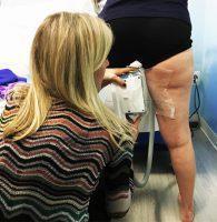 Coolsculpting Inner Thigh Applicator Pic