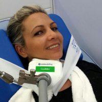 Coolsculpting Session Takes Roughly An Hour And Can Freeze Up To 30% Of The Fat From Under Your Chin