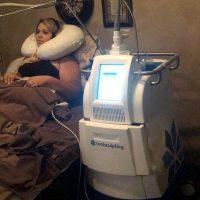 The CoolSculpting System Is A Portable Thermoelectric Cooling And Heating Device