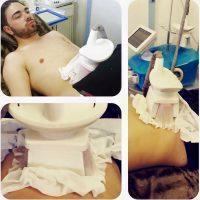 Cryolipolysis, Completely Destroys The Fat Cell