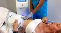 Freezing Off Your Fat With Cryogenic Lipolysis