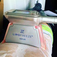 LipoFreeze Is Different To Other Non-surgical Lipo Treatments That Use Lasers