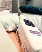 CoolSculpting Applies A Vacuum To Your Fatty Area