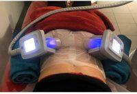 Cryo Fat Freezing Non-surgical Treatment Aims To Remove Fat Cells From Problem Areas